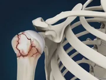 Dr. SrinivasKasha Orthopedic Surgeon