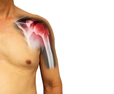 Orthopedic Hip Specialist
